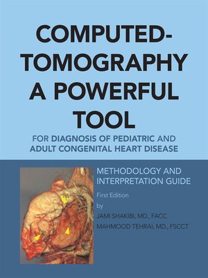 cover image of Computed-Tomography a Powerful Tool for Diagnosis of Pediatric and Adult Congenital Heart Disease